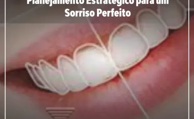 Estética do Sorriso para Eventos Especiais: Planejamento Estratégico para um Sorriso Perfeito